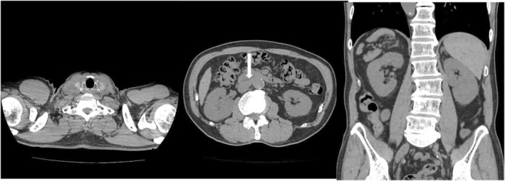 FIGURE 4