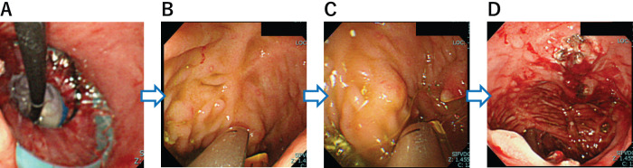 Fig. 2
