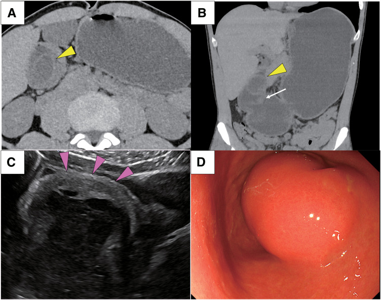 Fig. 1