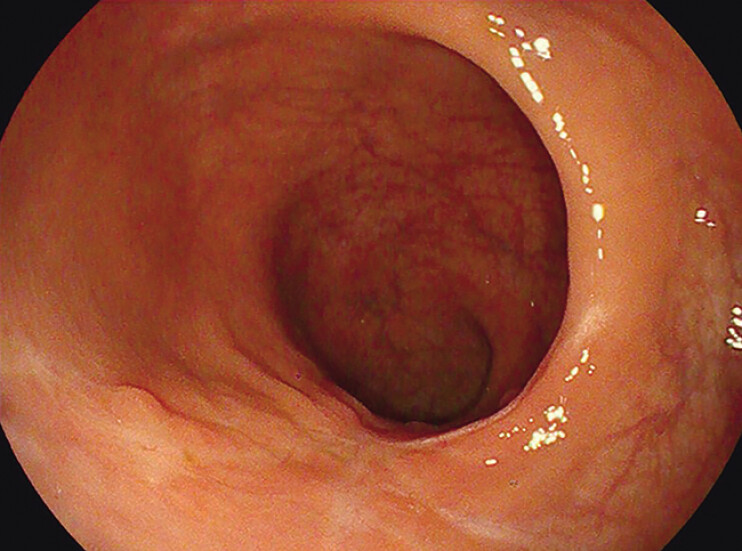 Fig. 5