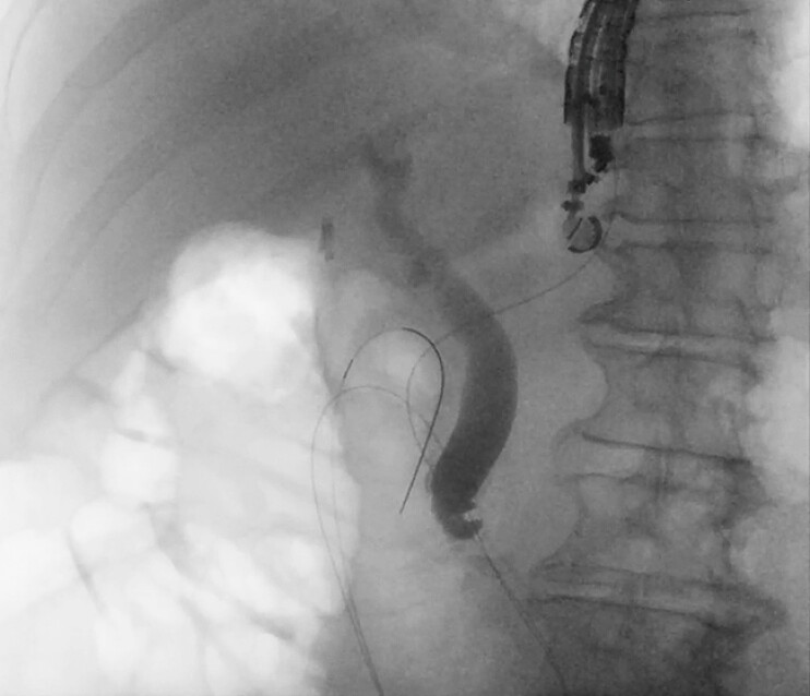Fig. 4