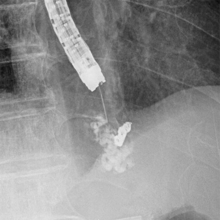 Fig. 3