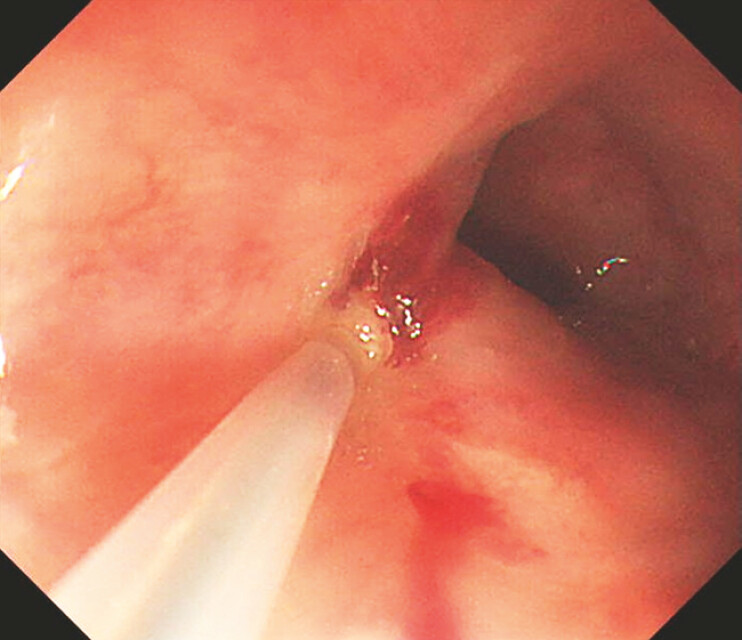 Fig. 4