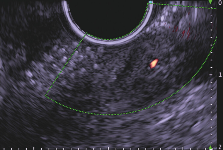 Fig. 4