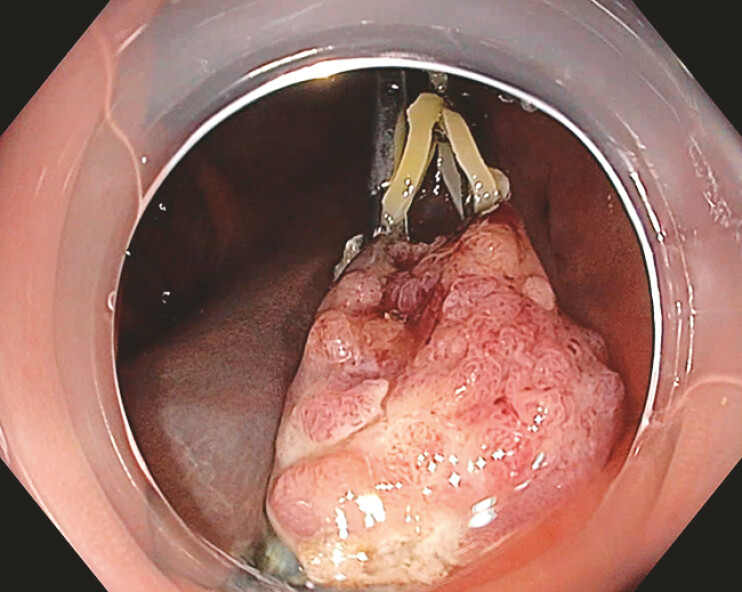 Fig. 4