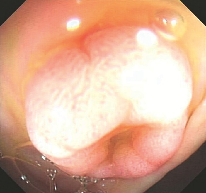 Fig. 1