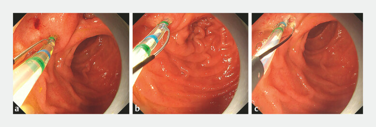 Fig. 2