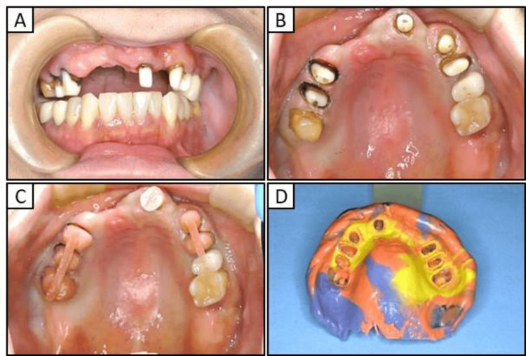 Figure 4