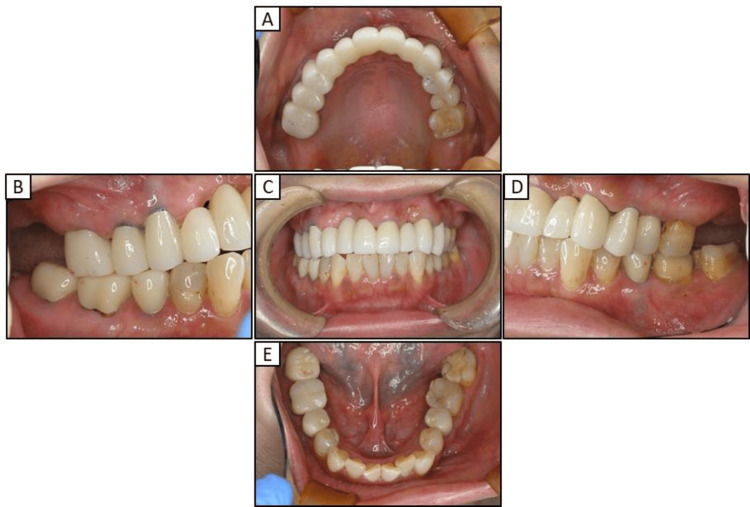 Figure 5