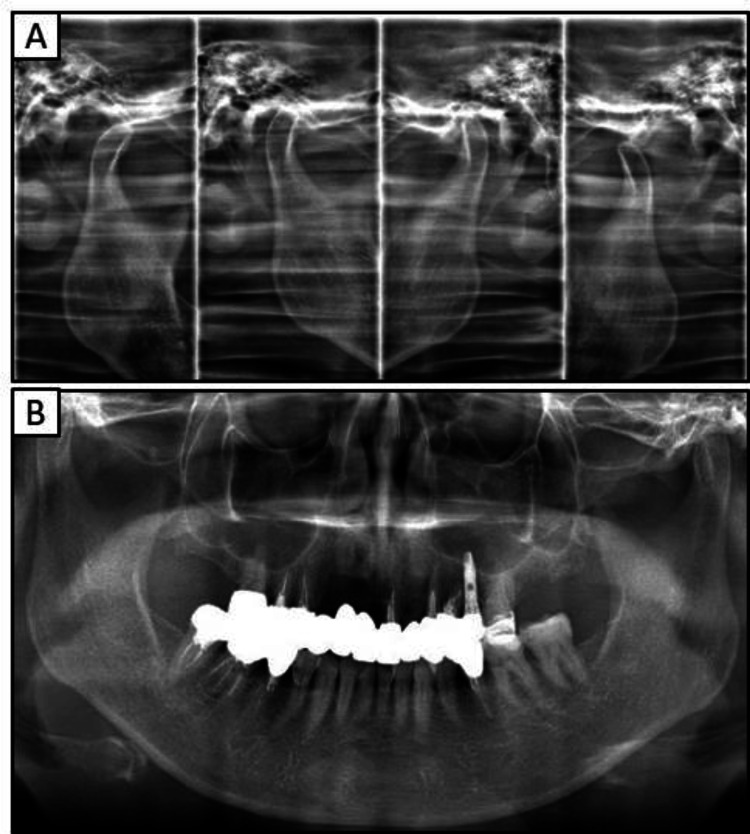 Figure 6