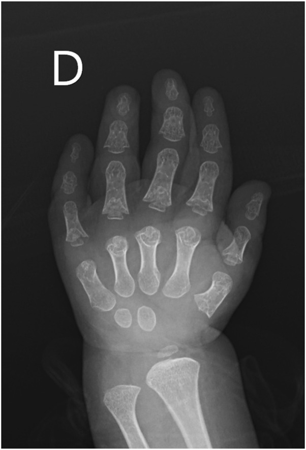 FIGURE 4
