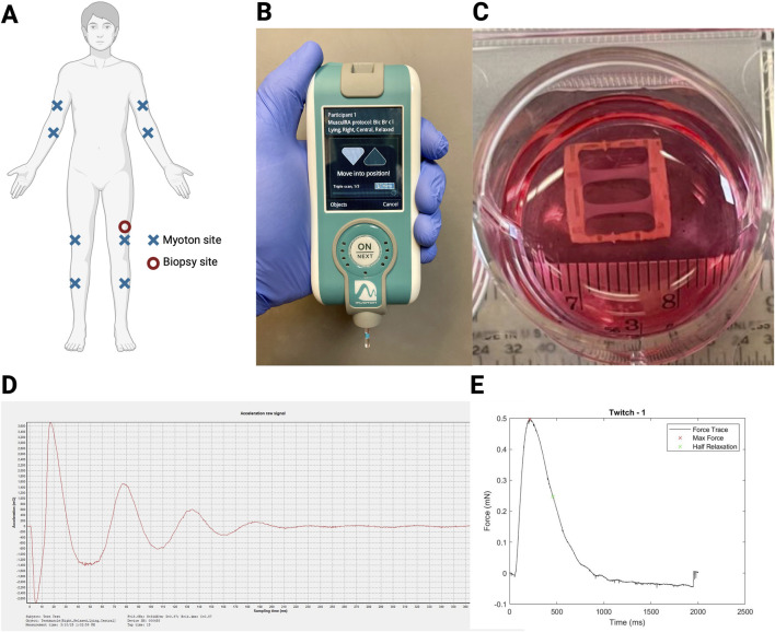FIGURE 1