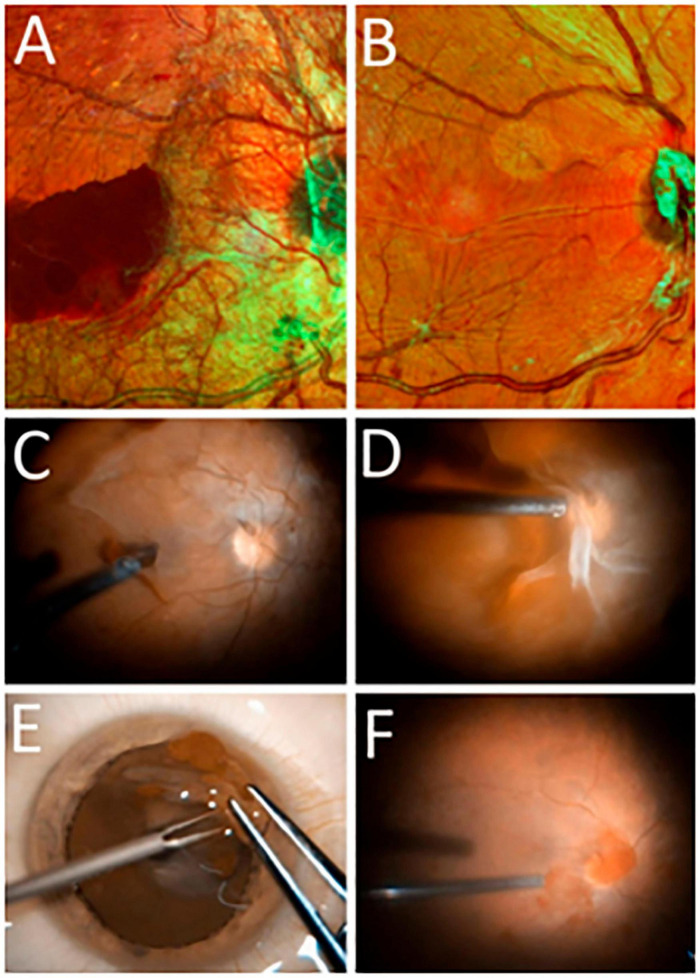 FIGURE 2