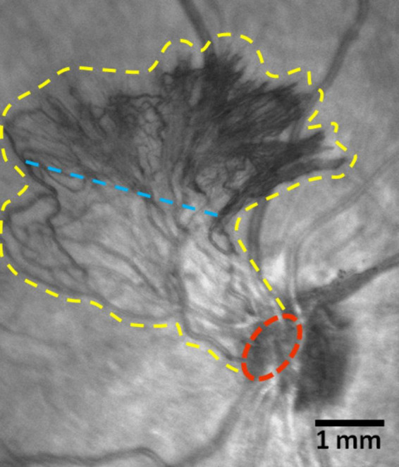FIGURE 3