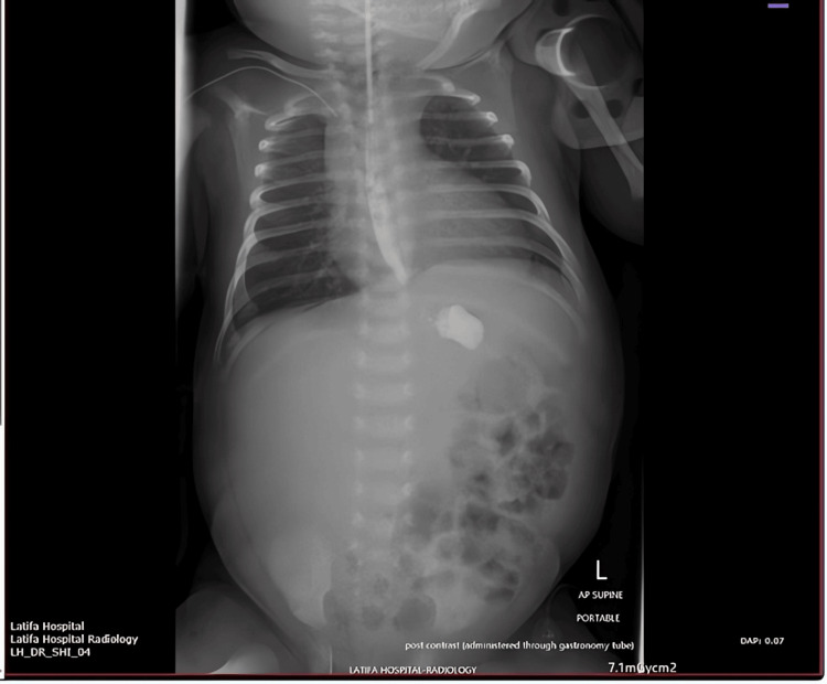 Figure 9