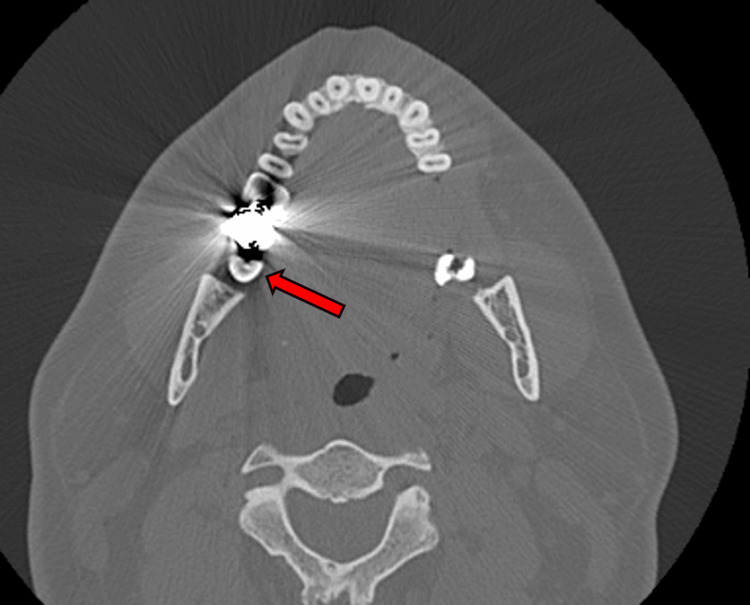 Figure 6