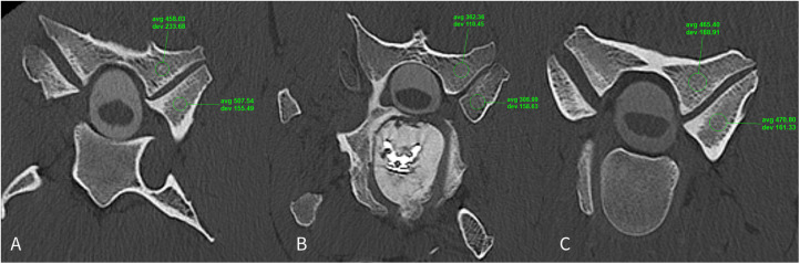 Figure 12