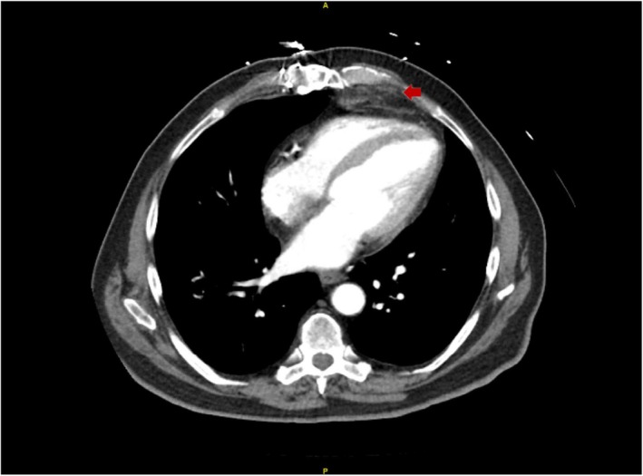 FIGURE 7