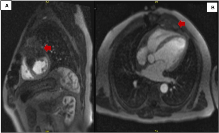 FIGURE 6