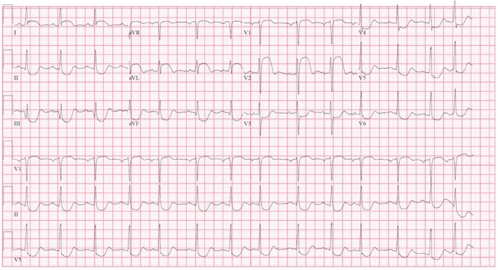 FIGURE 2