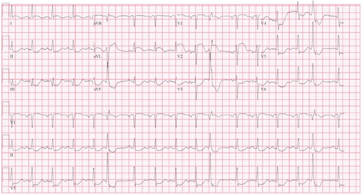 FIGURE 1
