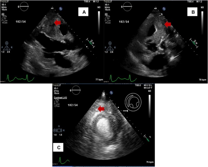 FIGURE 5