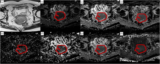 FIGURE 1