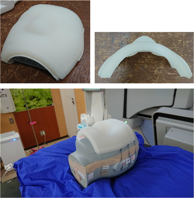 FIGURE 2