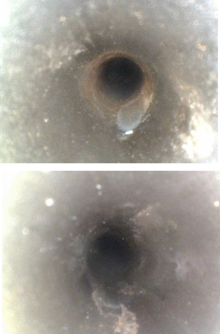 Fig 4