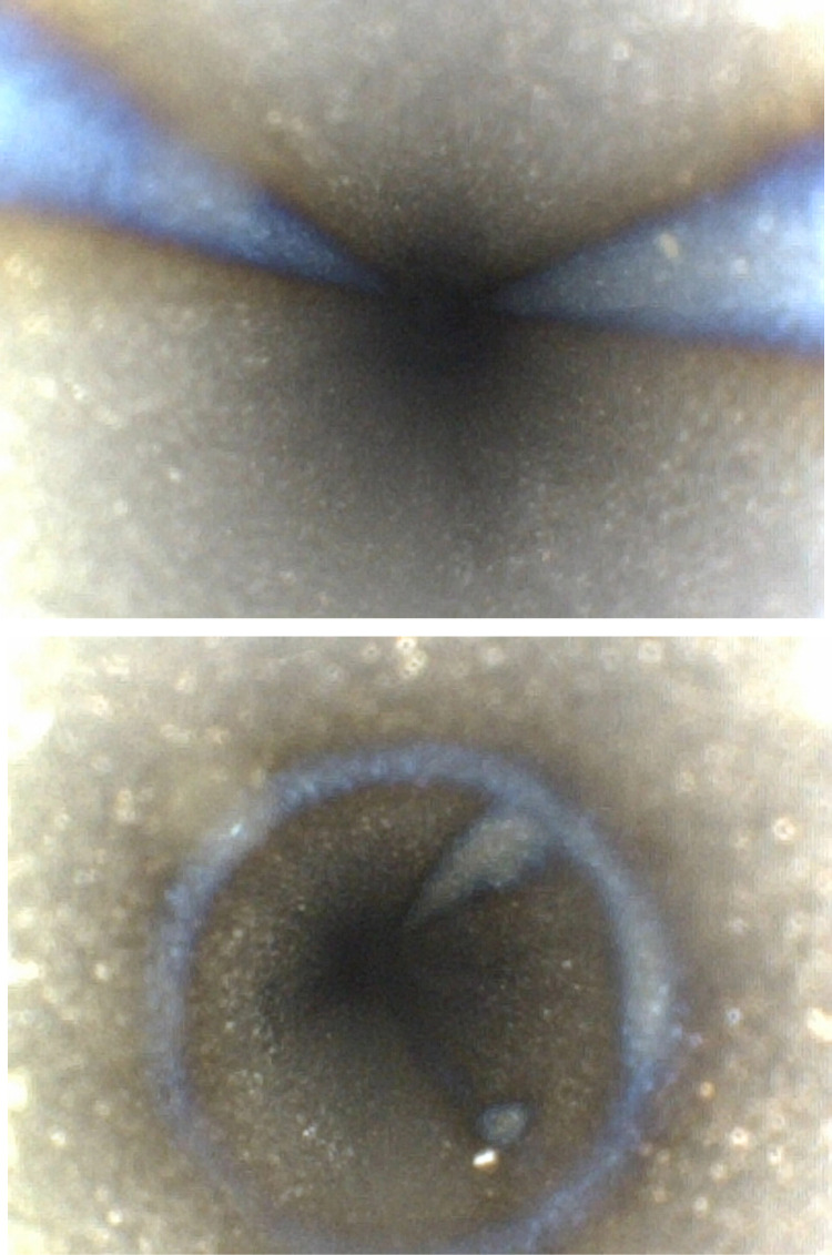 Fig 5