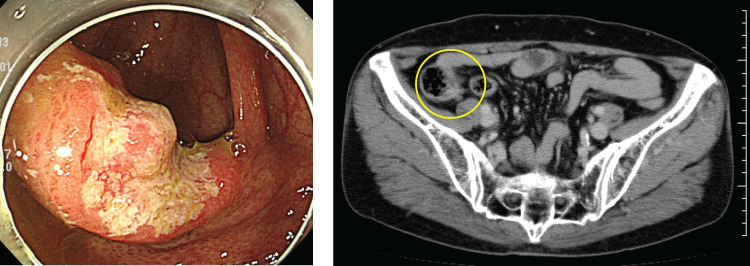 Fig. 2