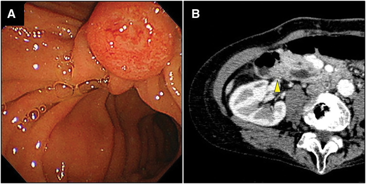 Fig. 1