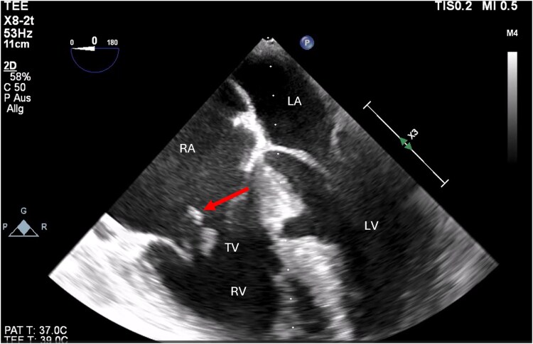 Figure 4