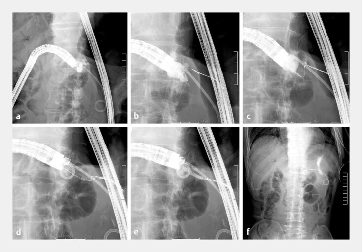 Fig. 4
