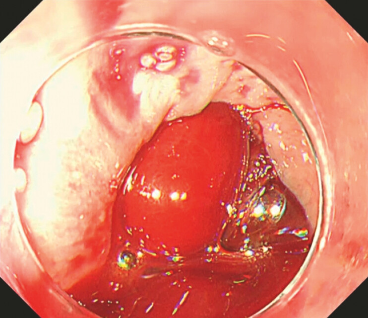 Fig. 2