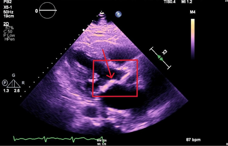 Figure 6