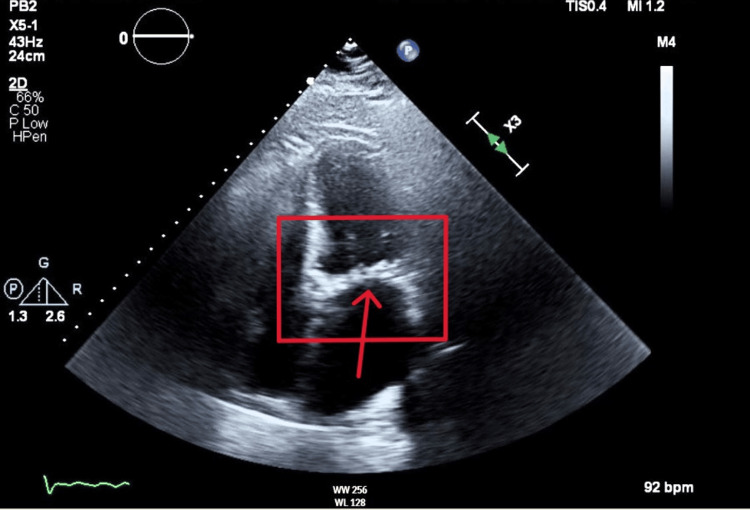 Figure 7