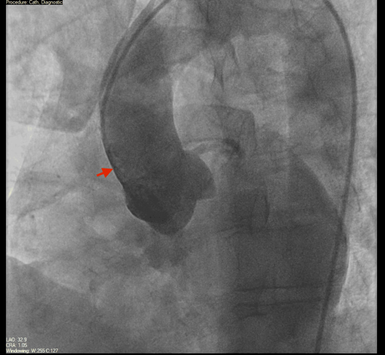 Figure 6