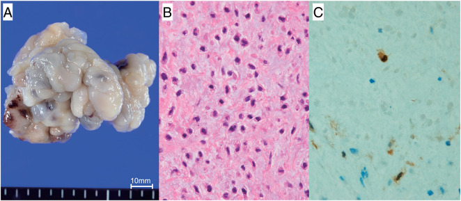 Fig. 3