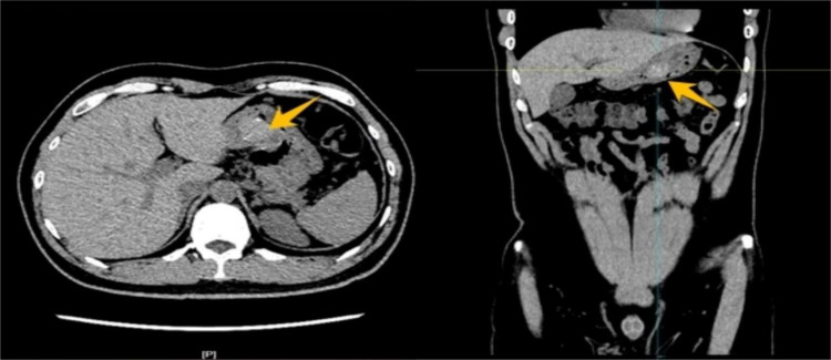 Figure 1