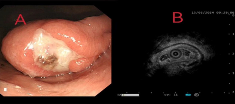 Figure 2