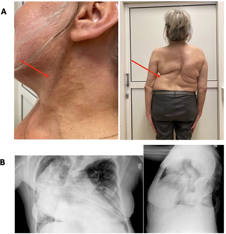 Figure 1