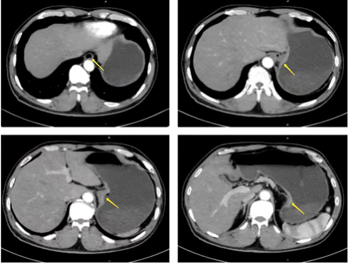 Figure 1