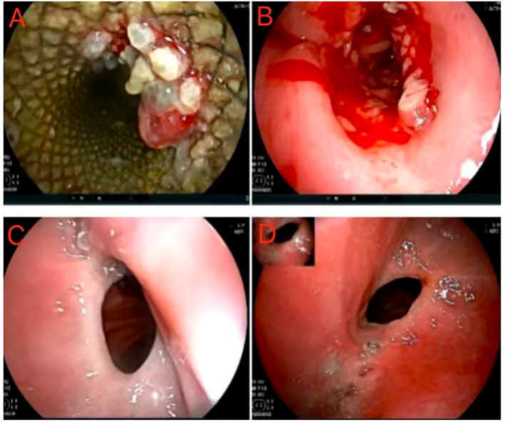 Figure 4