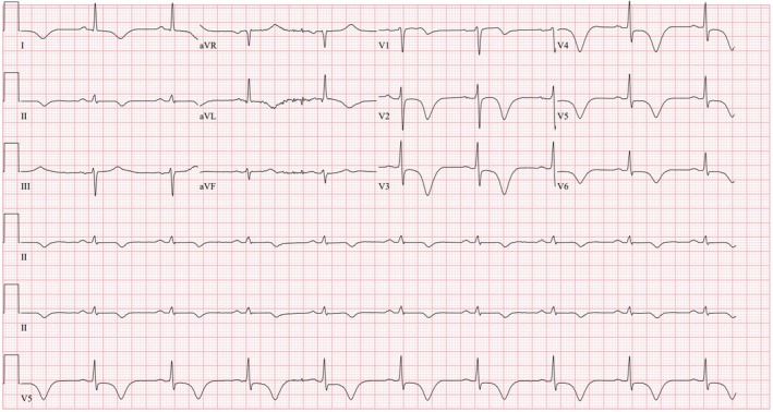 FIGURE 1