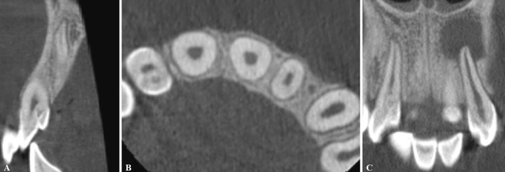 FIGURE 4