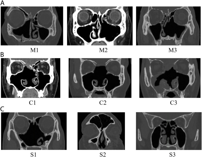 Fig 2