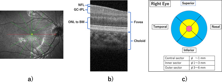 Fig 1
