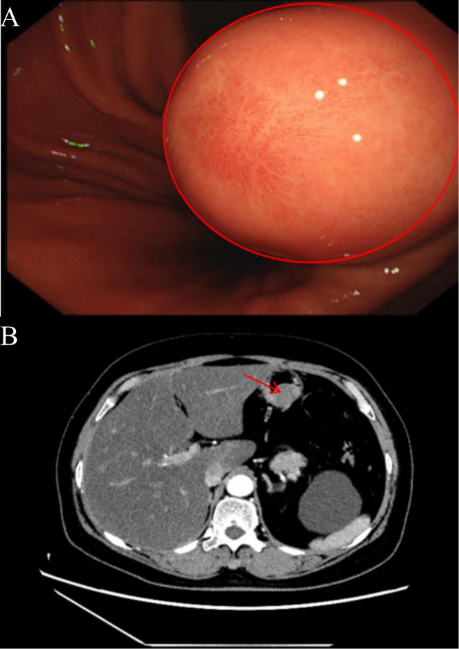 Figure 1