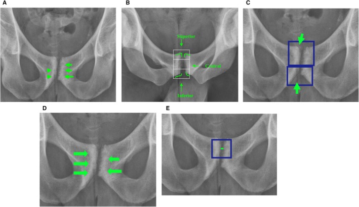 FIGURE 2